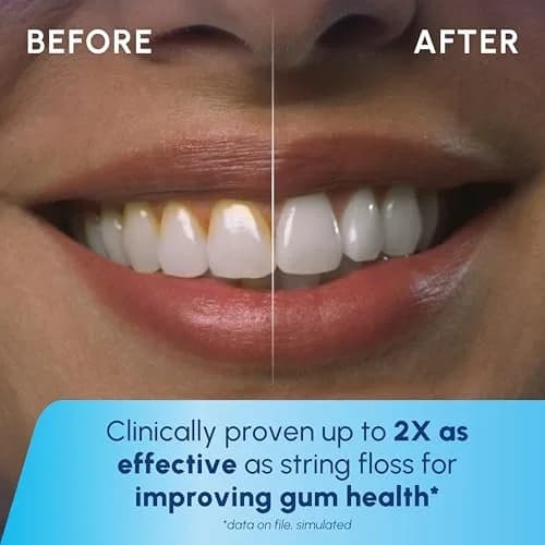 Waterpik Cordless Express Portable Water Flosser White 5 fl oz (148 ml) | Dentist Recommended Oral Irrigator thumbnail 7