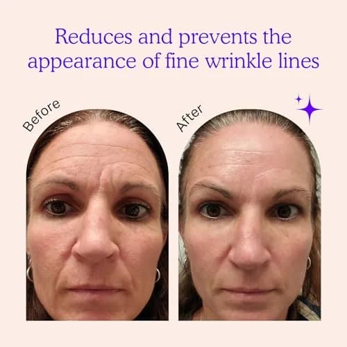 BLUMBODY Wrinkle Patches for Face, Forehead, Smile Lines & Eyes 165 pcs | Reusable Silicone Anti-Wrinkle Patches thumbnail 2