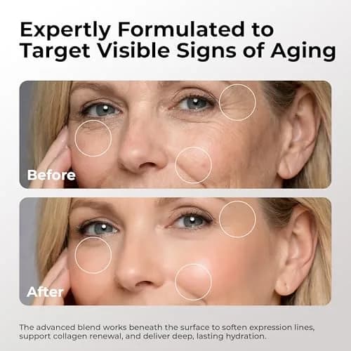 SKIN DEVA 20% Argireline Serum with Matrixyl 3000 & Hyaluronic Acid for Face | Deep Wrinkle Reducer, Anti-Aging, Skin Toning, Collagen Boost, 1 Fl Oz thumbnail 3