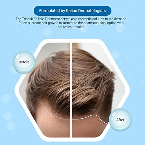 Tricovit Forte Hair Loss Treatment - Hair Growth Products for Women & Men - Sebum Regulator (2.7 Fl Oz) thumbnail 2