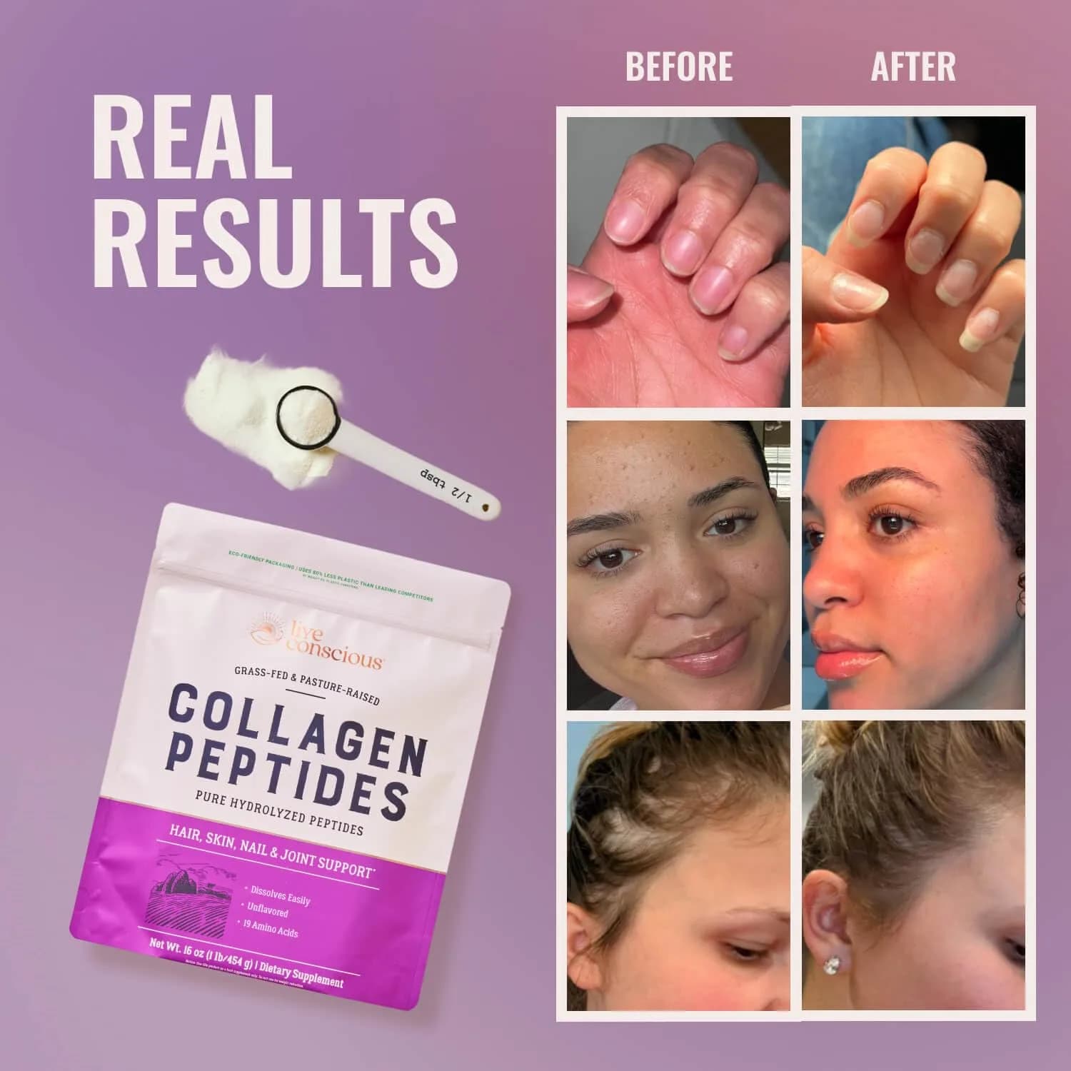 Live Conscious Unflavored Collagen Peptides Powder Packets (1 Pound) | 5 Types of Collagen for Hair, Skin, Nails & Joints - view 2