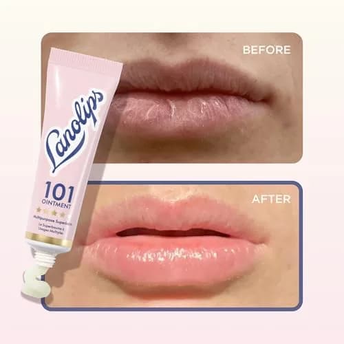 Lanolips 101 Ointment Multipurpose Balm 0.52 oz (15g) | Pure Lanolin for Dry Lips & Skin thumbnail 6