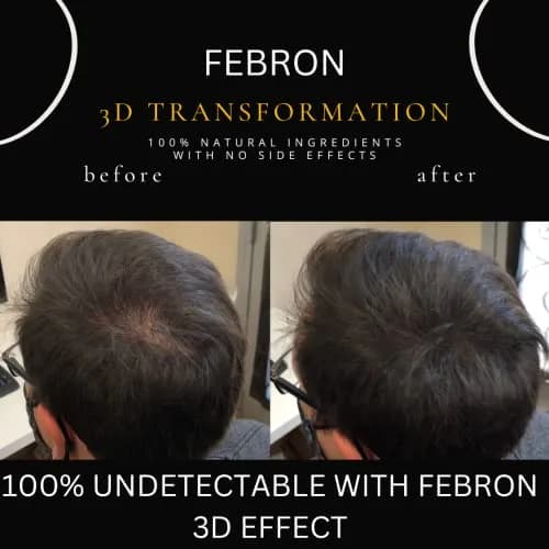 FEBRON Hair Fibers For Thinning Hair Medium Brown 30g | Natural, Undetectable & Lasts All Day thumbnail 6