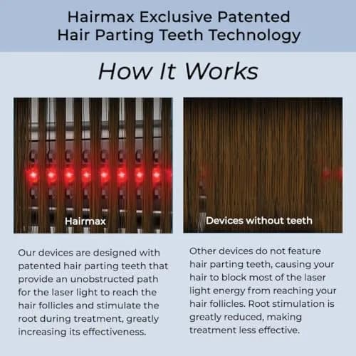 Hairmax Ultima 9 Classic LaserComb | FDA Cleared Red Light for Hair Regrowth in India thumbnail 5
