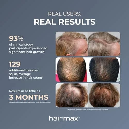 Hairmax Ultima 9 Classic LaserComb | FDA Cleared Red Light for Hair Regrowth in India thumbnail 3