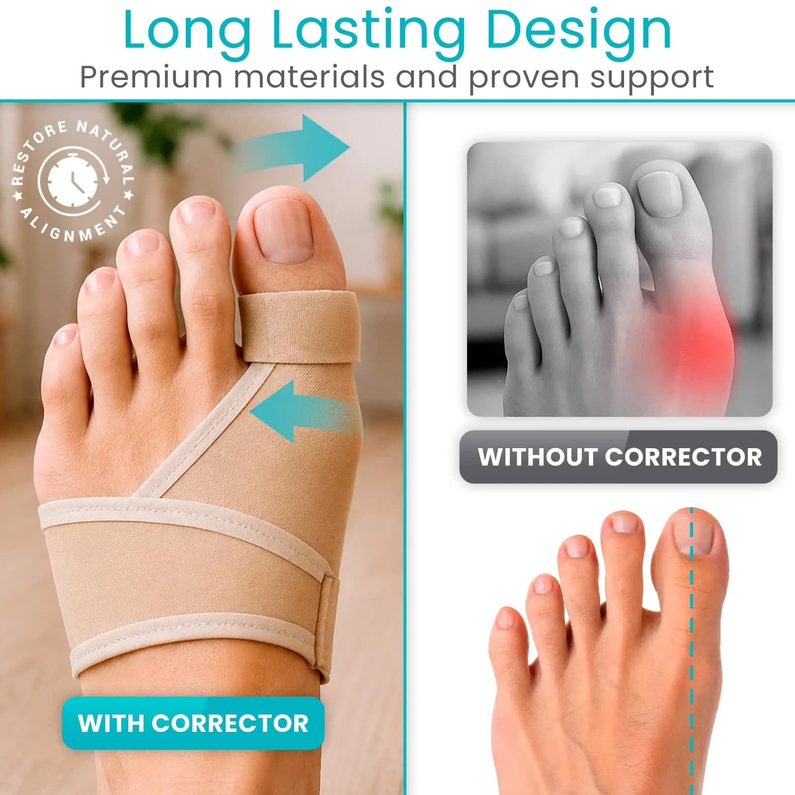 Vive Bunion Brace Pair - Beige 2 Count (Pack of 1) | FDA Approved Orthopedic Brace for Big Toe Pain Relief - view 4