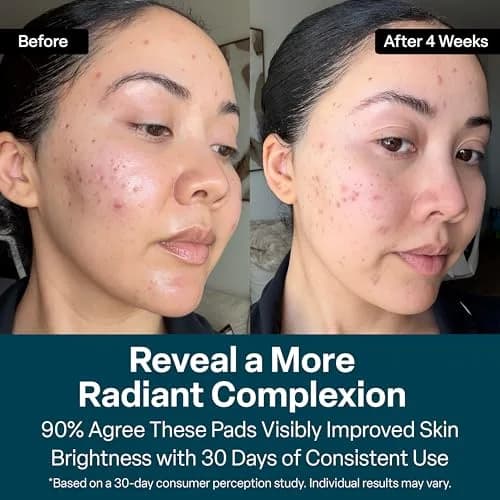 QRxLabs Glycolic Acid Pads 20% Resurfacing AHA for Face & Body 50ct | Exfoliates Skin Surface thumbnail 6