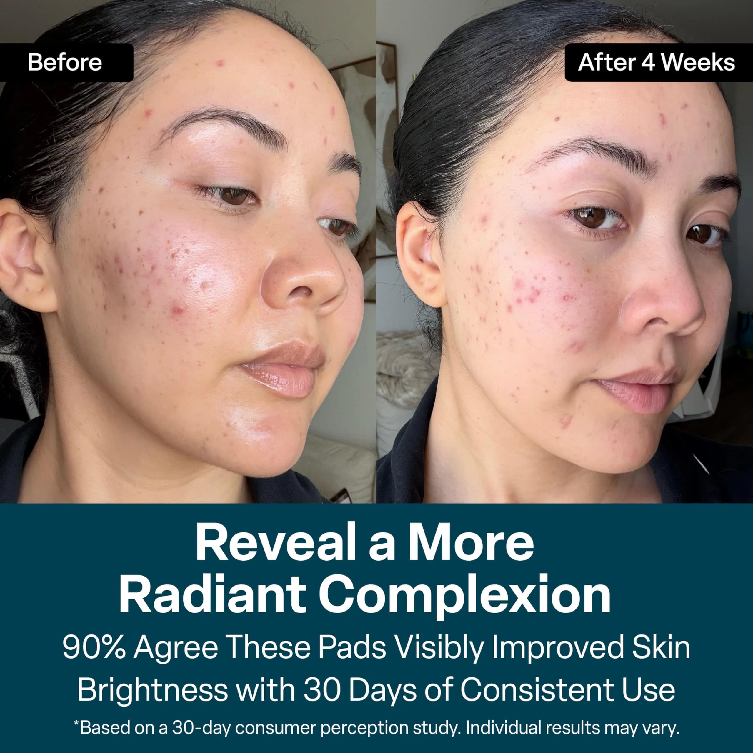 QRxLabs Glycolic Acid Pads 20% Resurfacing AHA for Face & Body 50ct | Exfoliates Skin Surface - view 6