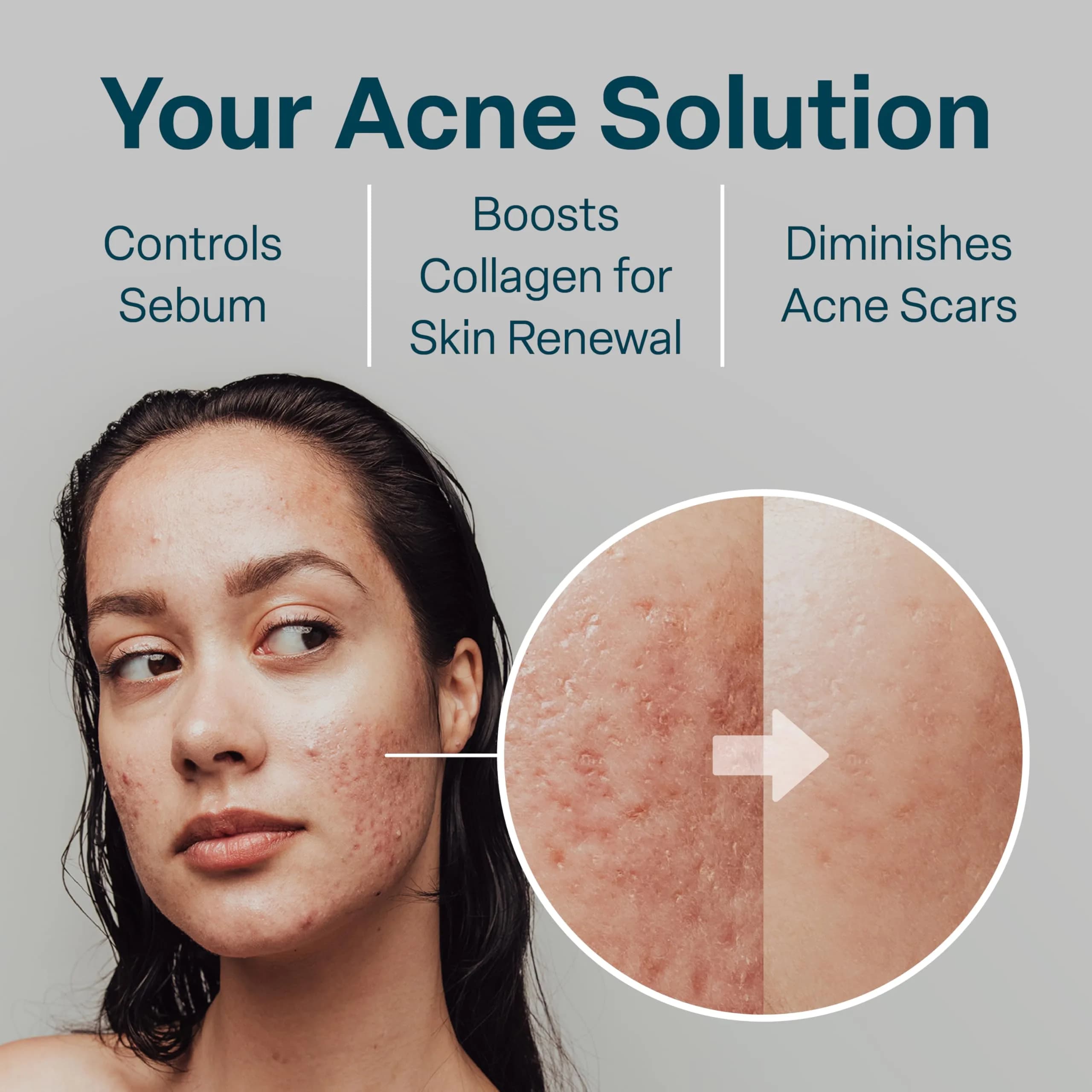 QRxLabs Salicylic & Glycolic Acid Acne Clearing Pads 50ct | Dual-Action Exfoliation for All Skin Types - view 4