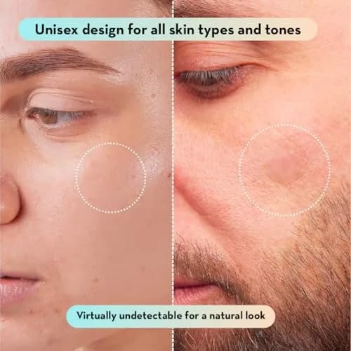 LE GUSHE Korean Pimple Patches with Tea Tree Oil | Hydrocolloid Acne & Zit Patches | 132 Dots | Dermatologist Tested thumbnail 8