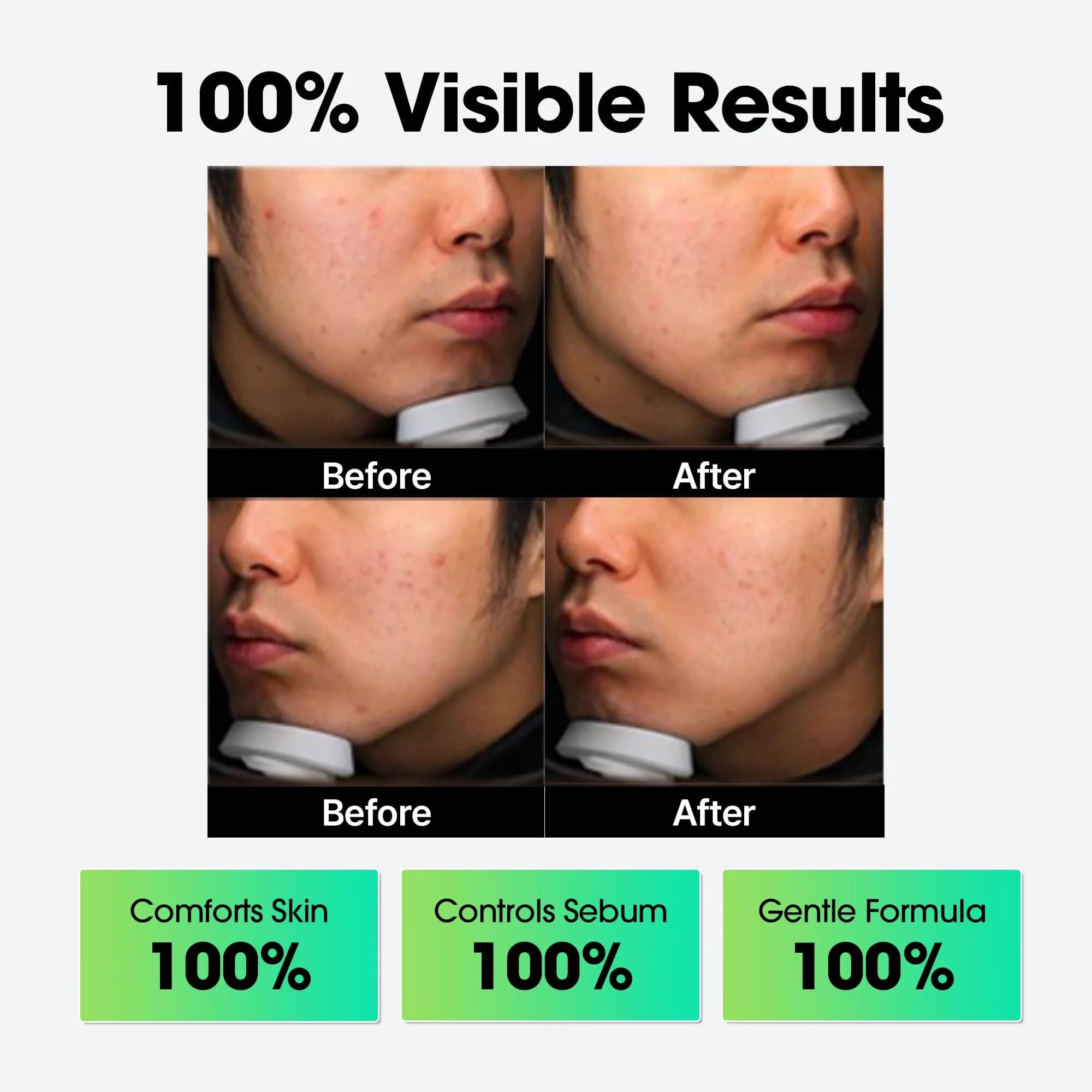 SOME BY MI AHA BHA PHA Miracle Cream 60ml (2.02 Fl Oz) | Mild Refining & Centella Face Moisturizer - view 8