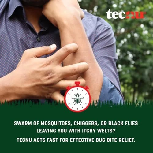 Calagel Anti Itch Gel for Poison Ivy & Bug Bites/Stings, Rashes 6 Oz | Maximum-Strength Skin Calming Gel for Itches & Rashes thumbnail 3