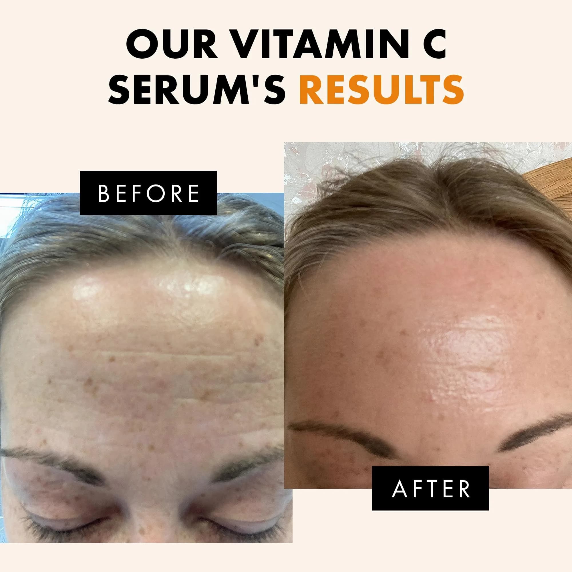 Eclat Skincare Vitamin C Serum 30ml (1 Fl Oz) | Brightens Skin & Reduces Dark Spots - view 4