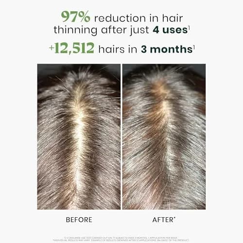 René Furterer Triphasic Reactional Hair Thickening Serum, 1.92 Fl Oz | Supports Hair Vitality & Thinning thumbnail 3
