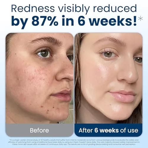 Clean Skin Club Clean Towels XL® Disposable Face Towels 50 Count (1.5 lb) | USDA Biobased & Dermatologist Approved thumbnail 3
