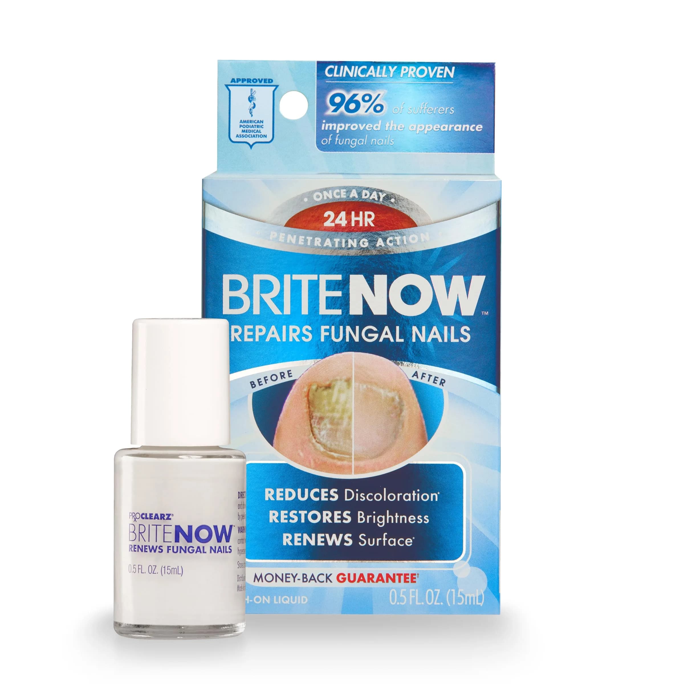 ProClearz Brite Now Nail Treatment 0.5 Fl Oz | Brightening & Smoothing Nail Repair — White