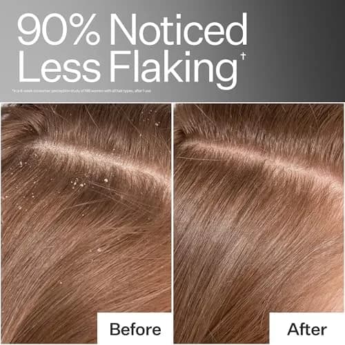 ACT+ ACRE Cold Processed Scalp Detox Oil 3 Fl Oz | Sulfate-Free for Dry & Itchy Scalp, Promotes Thicker Hair thumbnail 4