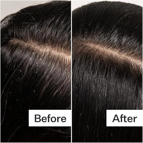 ACT+ ACRE Cold Processed Scalp Detox Oil 3 Fl Oz | Sulfate-Free for Dry & Itchy Scalp, Promotes Thicker Hair thumbnail 6