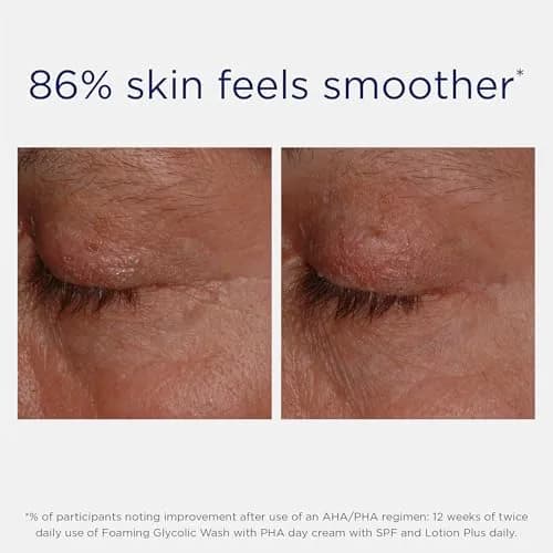 NEOSTRATA Foaming Glycolic Face Wash High Strength AHA Cleanser Soap-free 4.2 fl. oz. | Exfoliates & Cleanses for Experienced Glycolic Users thumbnail 7