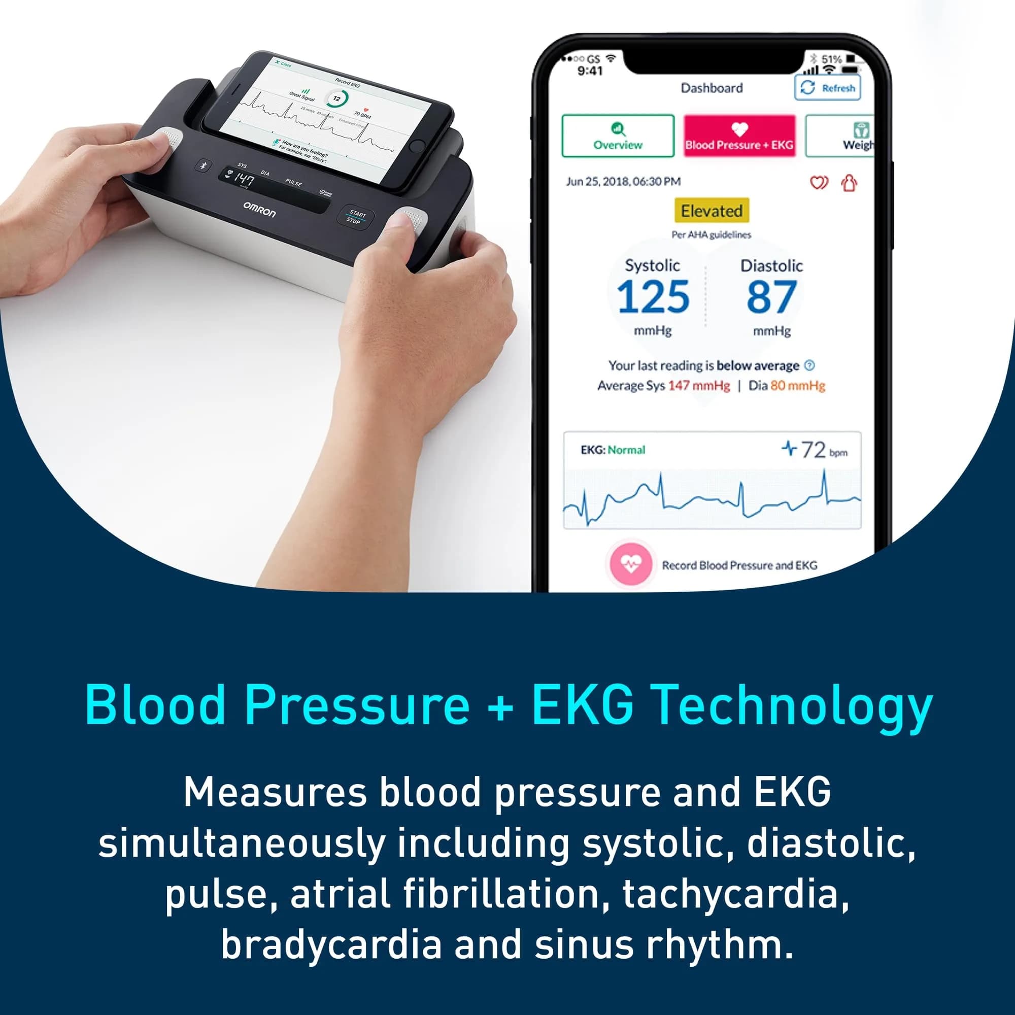 OMRON Complete 2-in-1 Blood Pressure Monitor + EKG BP7900 Black | Advanced Accuracy & Bluetooth Sync - view 3