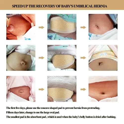 BOJEE Umbilical Hernia Belt for Infants & Kids | 48 cm (19 inch) Beige thumbnail 7