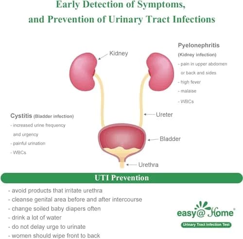Easy@Home Urinary Tract Infection Test Strips 25 Pack | Detects Leukocytes & Nitrites for Women thumbnail 8