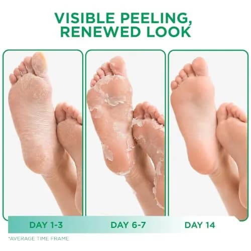 DERMORA Foot Peel Mask, Exfoliating Foot Peeling Mask, 2 Pairs, Tea Tree | Gentle Exfoliation for Dry Feet thumbnail 3
