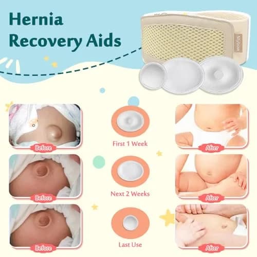 Mybow Umbilical Hernia Belt Baby | Gentle Support for Newborns (70-120 chars) thumbnail 3