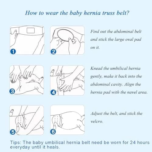 Paskyee Umbilical Hernia Belt for Newborns | Adjustable Cotton Navel Support Wrap, 4 Piece Set, Pink thumbnail 4