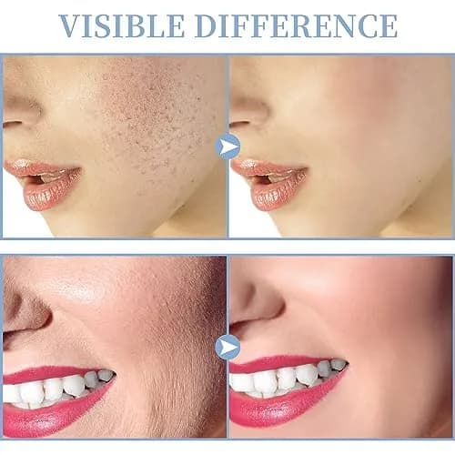 TUMAKOU High Frequency Facial Machine 14PCS | Portable Handheld Skin Therapy Device thumbnail 4