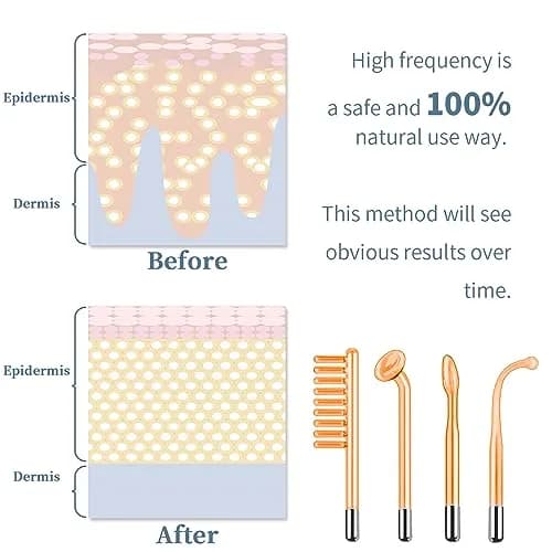 TUMAKOU High Frequency Facial Machine 14PCS | Portable Handheld Skin Therapy Device thumbnail 3