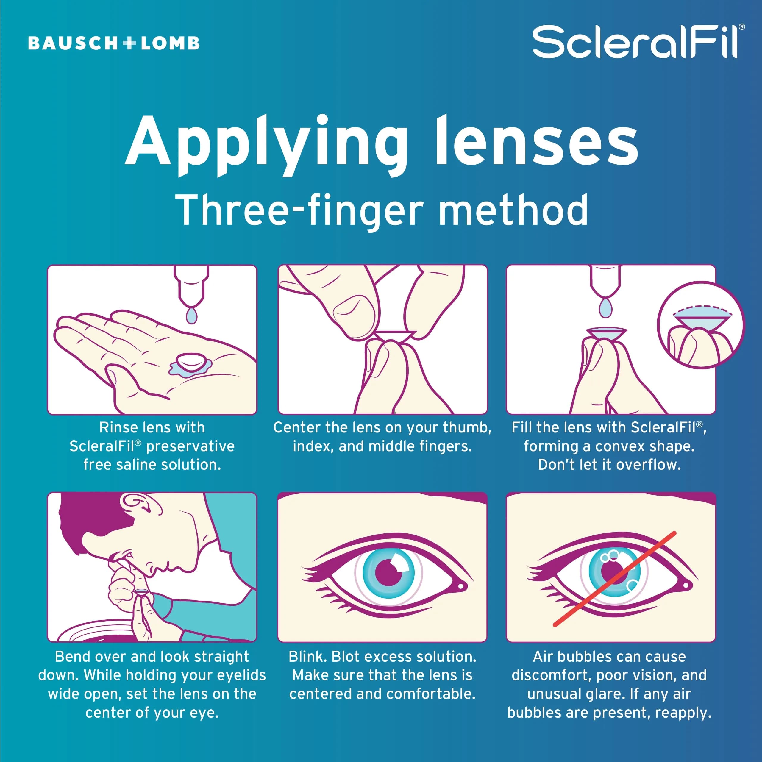 Bausch + Lomb ScleralFil Preservative Free Saline Solution for Scleral Lenses, Buffered Isotonic Rinsing & Insertion Solution for Soft and Rigid Gas Permeable Contacts, Single-Use Vials, 30 Count | 10.14ml (0.34 Fl Oz) Saline Solution - view 5
