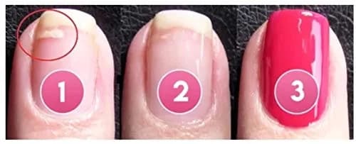 succeedtop Gel Nail Treatment 5ml | Instant Crack Repair & Strengthener thumbnail 5