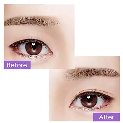 ZMBeauty Eyelid Tapes Stickers 800 pcs (400 Pairs) | Invisible Double Eyelid Tape for Hooded, Uneven, Mono-eye thumbnail 4