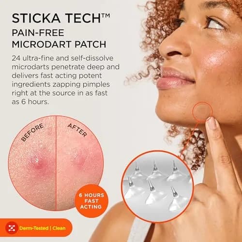 ZitSticka Killa Kit Microdart Pimple Patch for Face, 4 Count | Fast-Acting, Deep Zits Targeted thumbnail 2