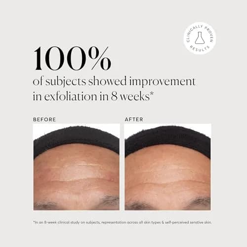 Naturium Azelaic Topical Acid 10% Serum 30ml (1 oz) | Reduces Redness & Improves Skin Tone thumbnail 4