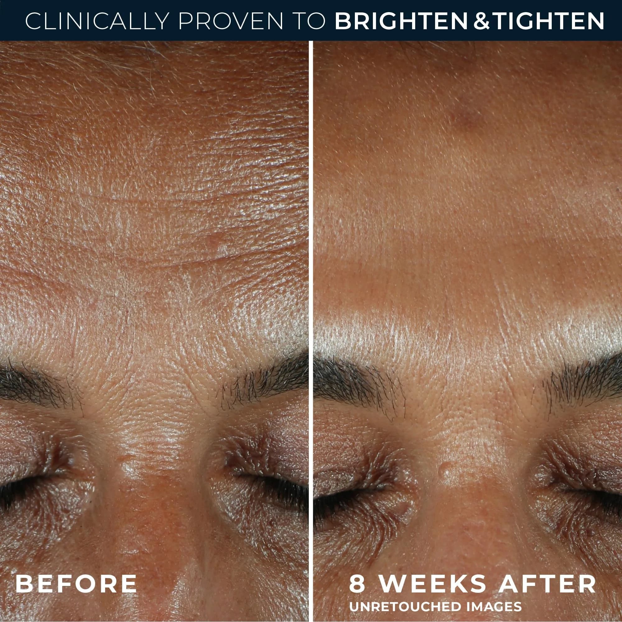 RoC Vitamin C Daily Serum 29.5ml (1oz) | Clinically Proven Brightening & Firming - view 5