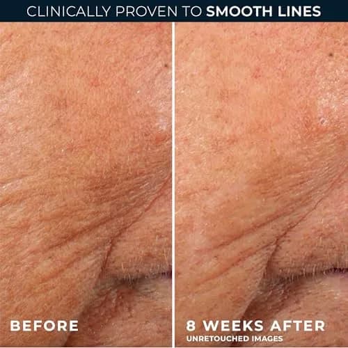 RoC Retinol Correxion Line Smoothing Night Serum Capsules 10 Count | Fragrance-Free Anti-Aging Treatment for Wrinkles thumbnail 5