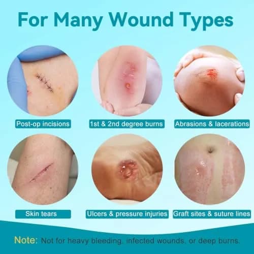 Dimora Silicone Wound Contact Layer 10 pcs | Non-adhering, Transparent, 7.5cm x 10cm thumbnail 5