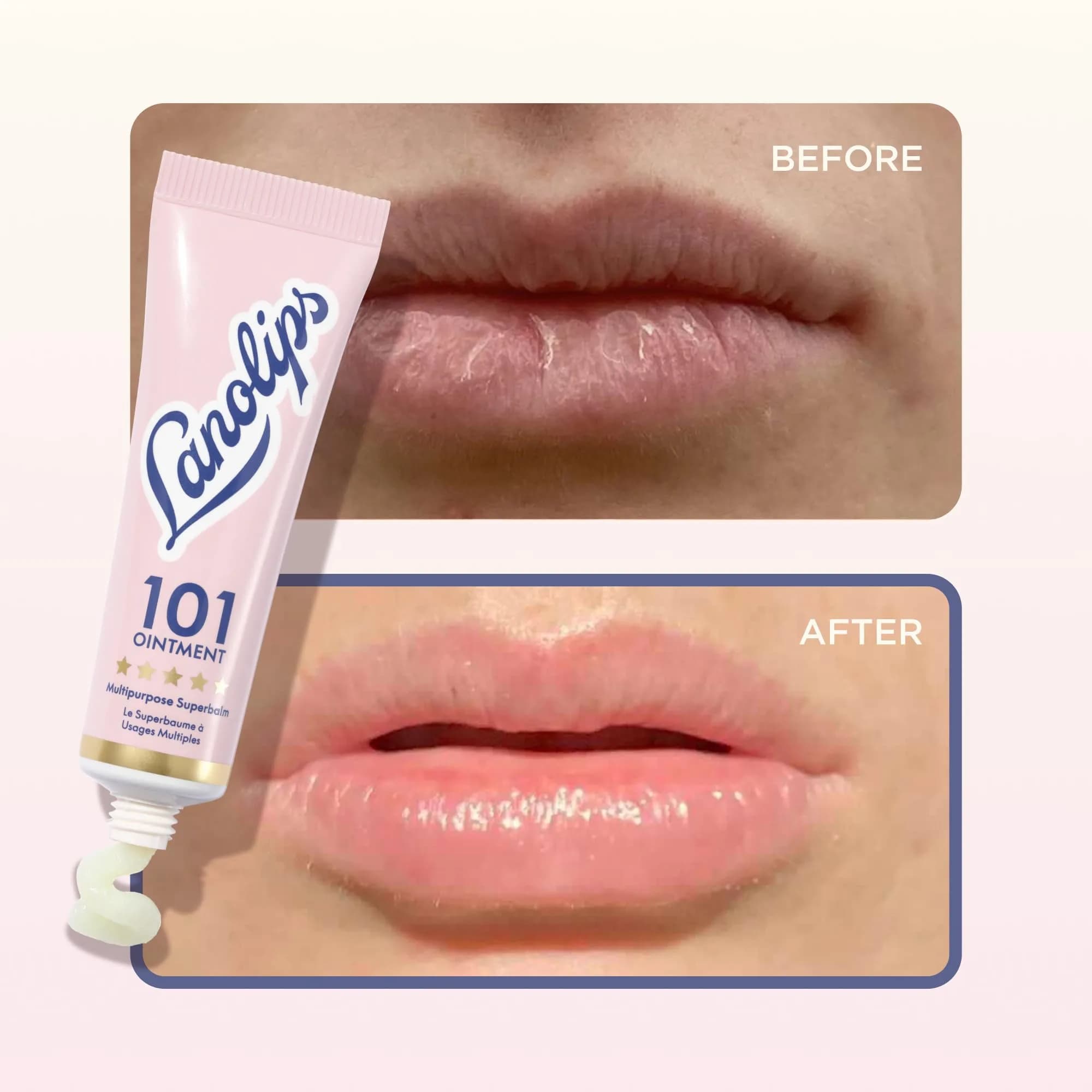 Lanolips 101 Multipurpose Ointment Duo 15ml (0.52 oz each) | Pure Lanolin Lip Balm & Skin Healer - view 6
