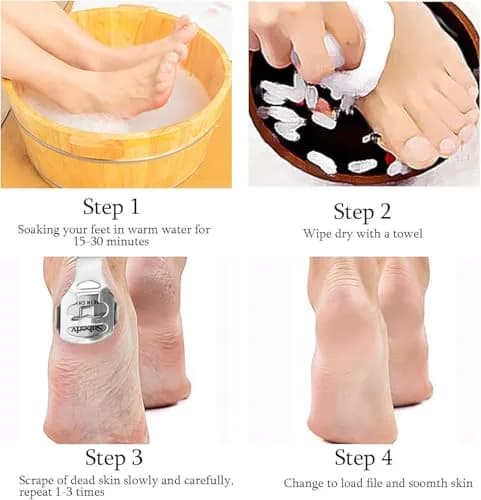 Jutoe Callus Shaver Set 52 Pcs | Stainless Steel Foot & Hand Care Tools thumbnail 5