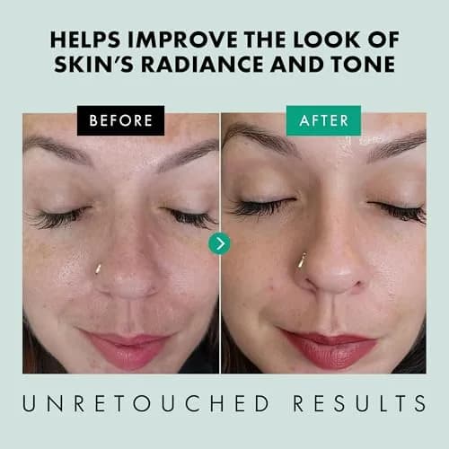 Eclat Skincare Clarifying Niacinamide Serum 30ml (1 Fl Oz) | Brightens Skin Tone & Minimizes Pores thumbnail 4