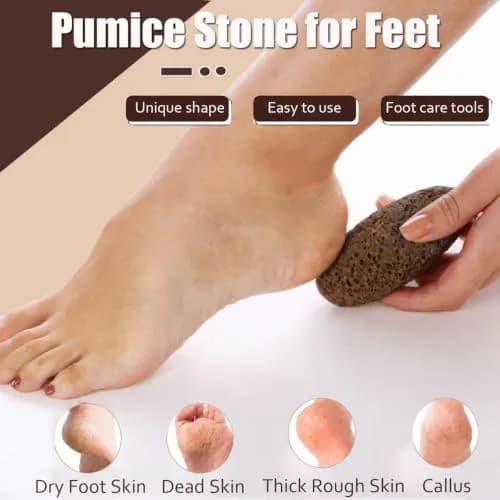 AKOAK Foot Pumice Natural Foot Scrubbing Stone | Pedicure & Foot Exfoliation Tool for Men & Women thumbnail 5