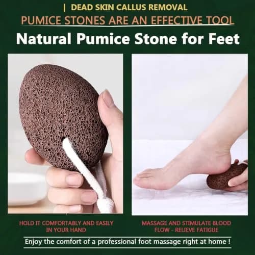 AKOAK Foot Pumice Natural Foot Scrubbing Stone | Pedicure & Foot Exfoliation Tool for Men & Women thumbnail 7