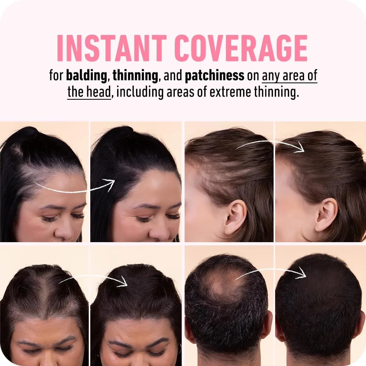 Boldify Hairline Powder Root Touch Up Dark Brown 4g | Instant Gray Coverage for Thinning Hair - view 5