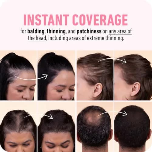 Boldify Hairline Powder Root Touch Up Dark Brown 4g | Instant Gray Coverage for Thinning Hair thumbnail 5