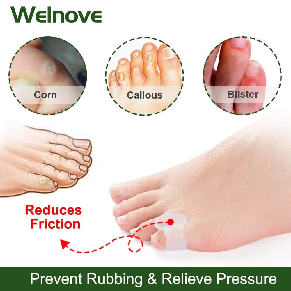 Welnove Gel Toe Separator Small Toe Cushions Pack of 12 | Prevents Rubbing & Reduces Pressure thumbnail 3