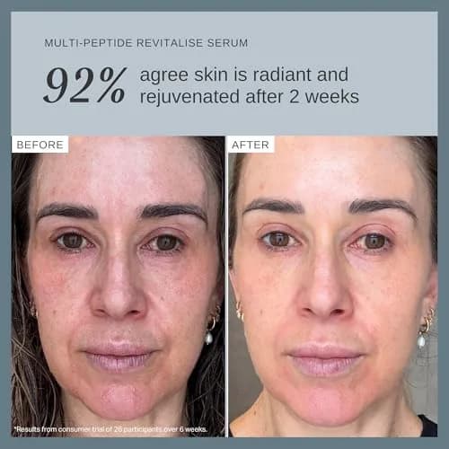 Alpha-H Multi-Peptide Face Serum 30ml | Firms & Plumps Fine Lines, Lightweight & Cruelty-Free thumbnail 4