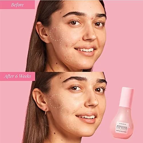 Glow Recipe Watermelon Niacinamide Dew Drops Serum 40ml (1.35 Fl Oz) | Instant Dewy Glow & Hydration thumbnail 7