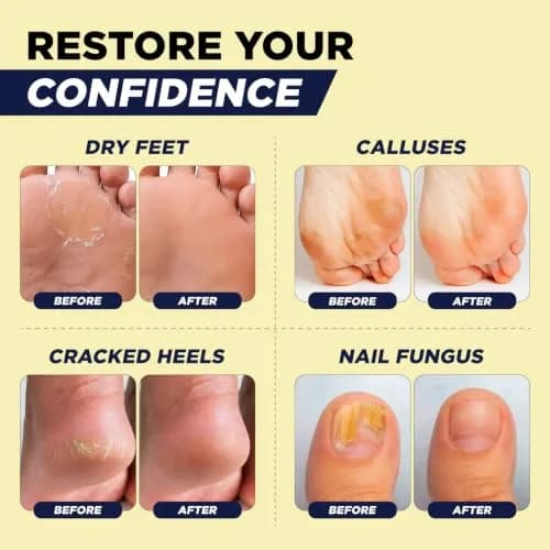 FOOT CURE Citrus Detox Epsom Salt Foot Soak 454 g (16 oz) | Cleanses & Revives Skin Tone thumbnail 5
